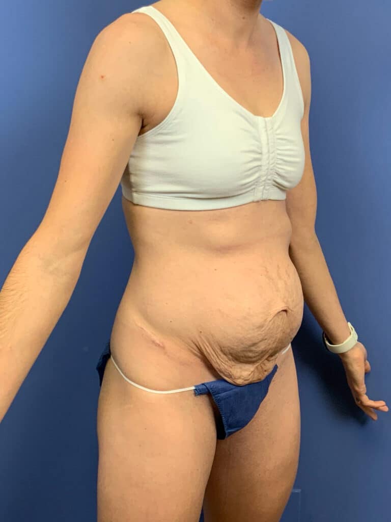 Before Image:  - right-front-oblique