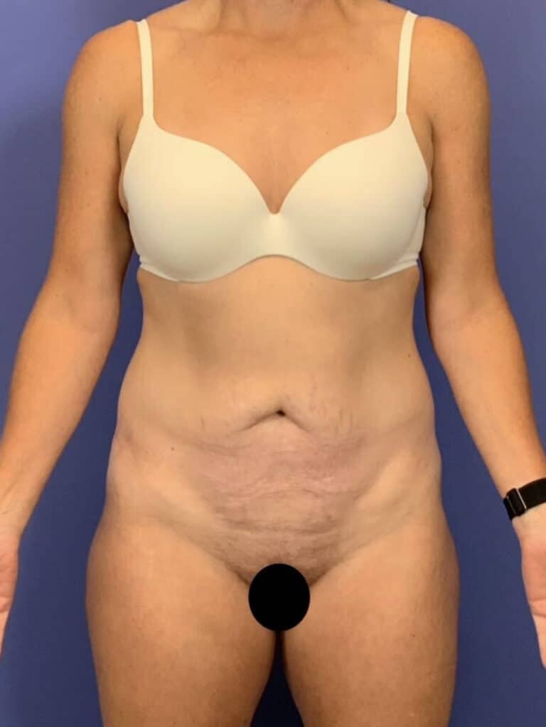 Before Image:  -
