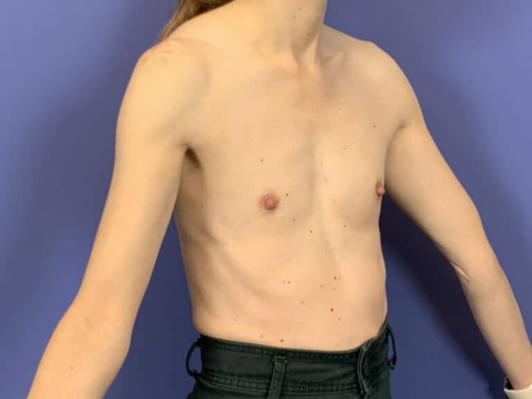 Before Image:  - right-front-oblique