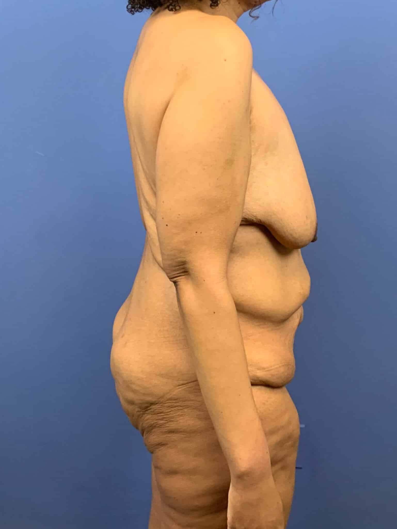 Before Image:  - right-side