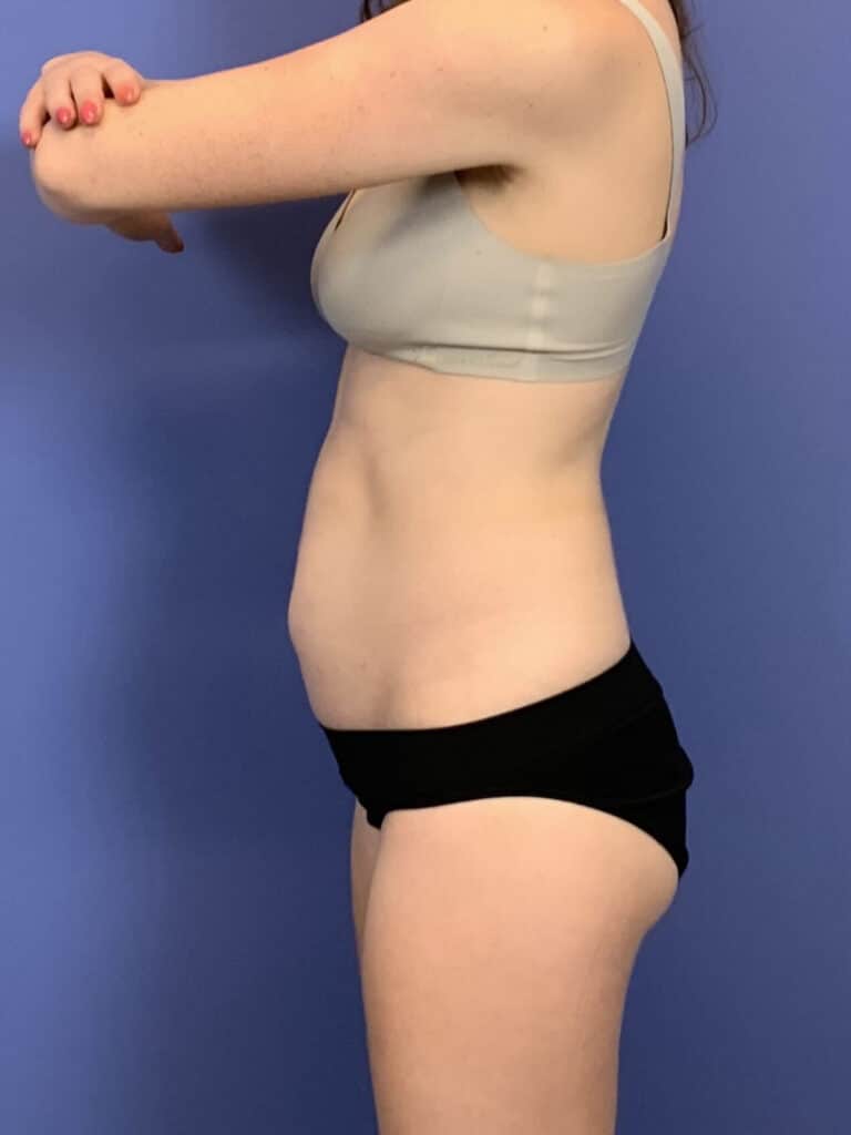 Before Image:  - front