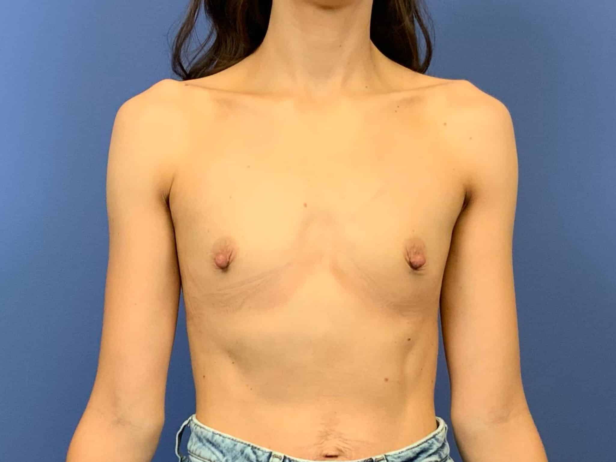 Before Image:  - front