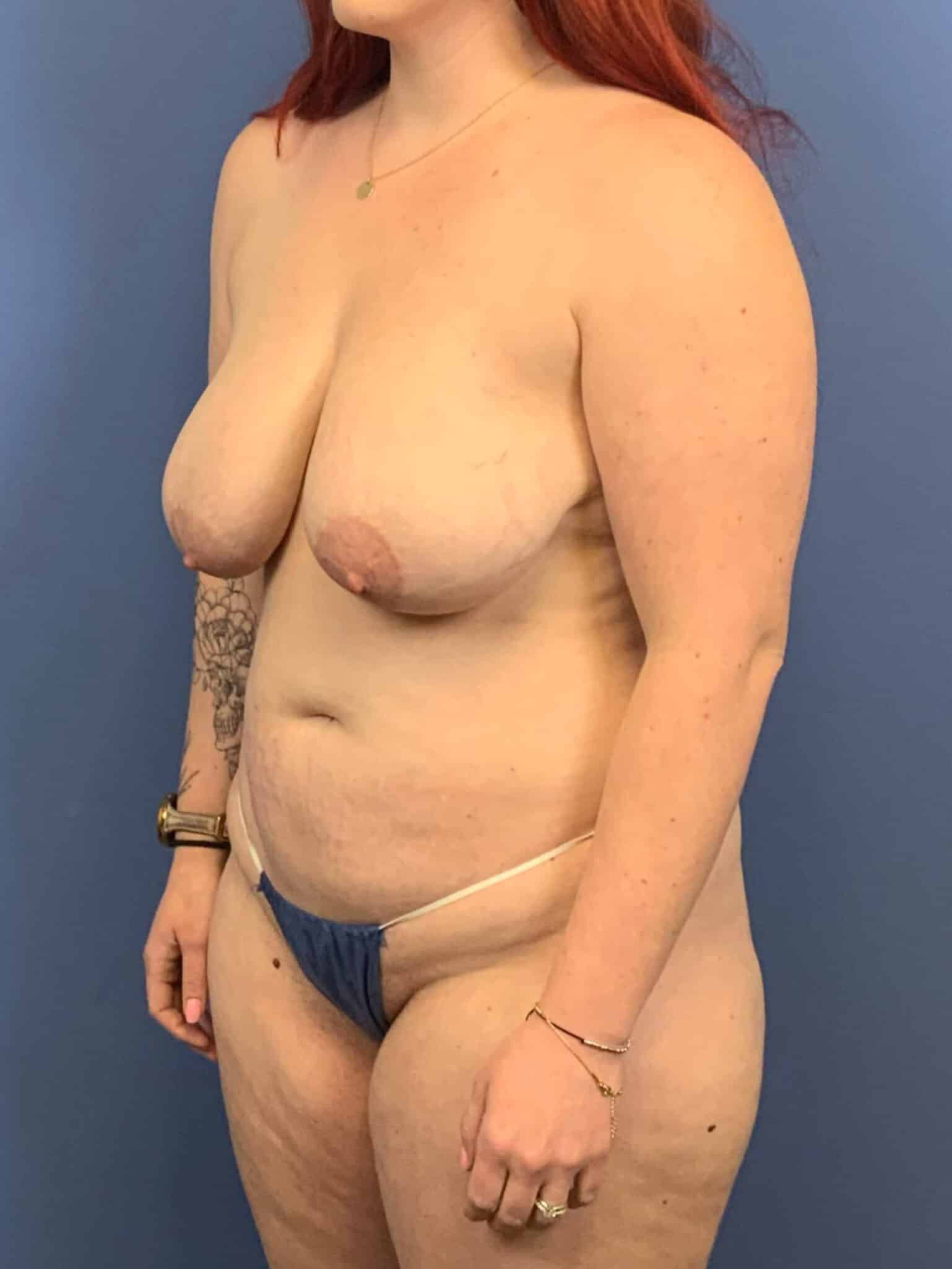 Before Image:  - left-front-oblique