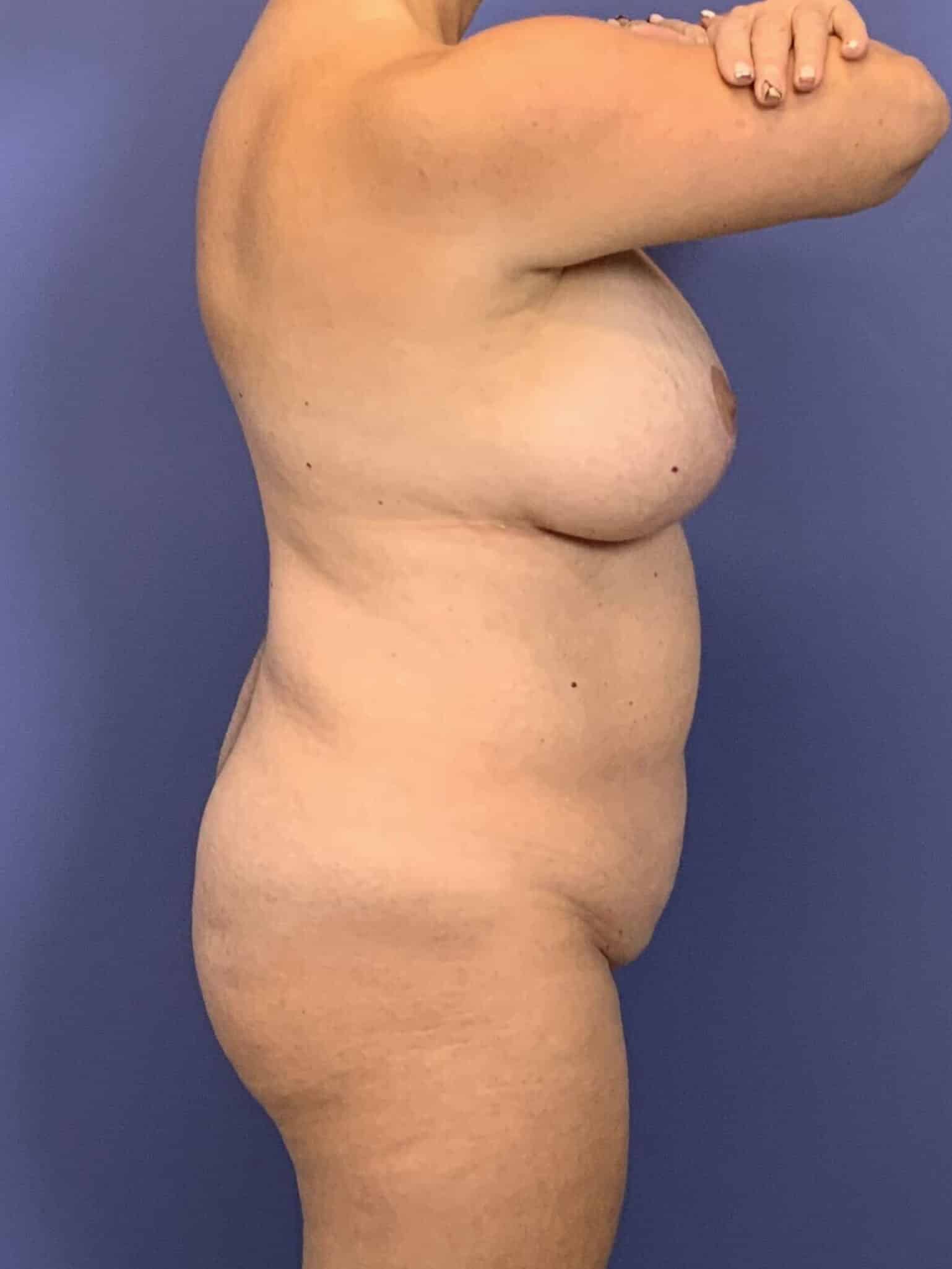 Before Image:  - right-side