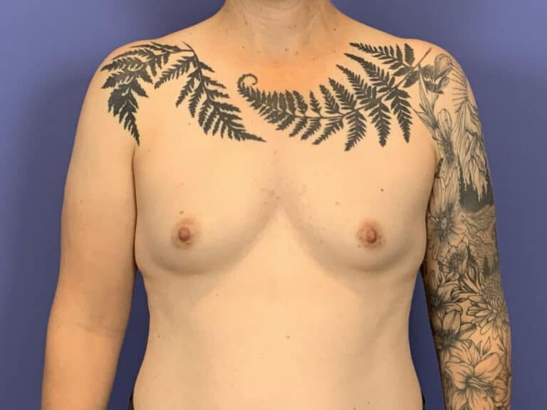 Before Image:  - front