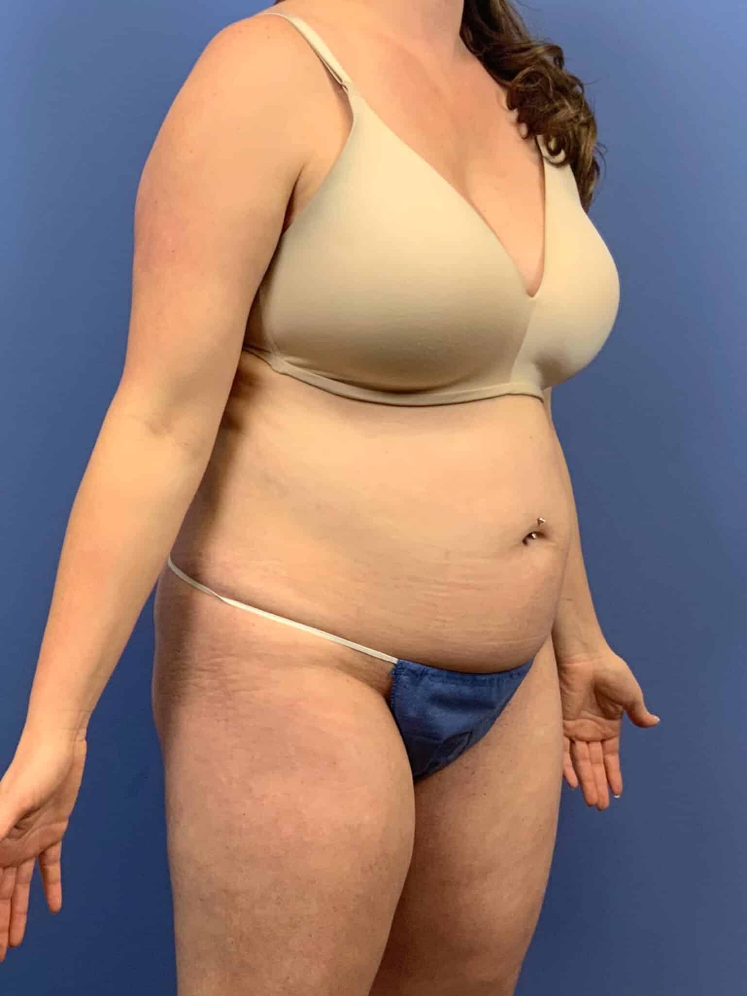 Before Image:  - right-front-oblique