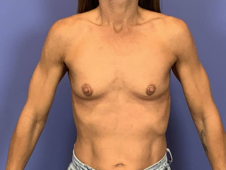 Before Image:  - front