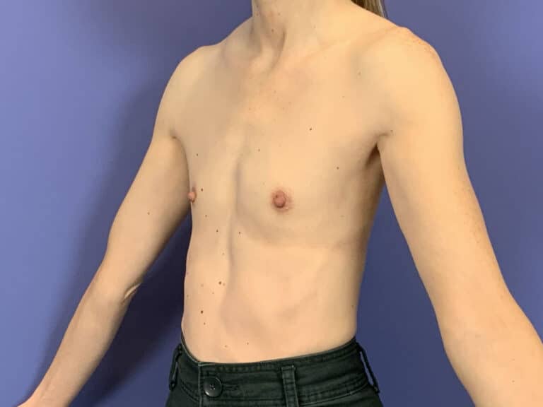 Before Image:  - left-front-oblique
