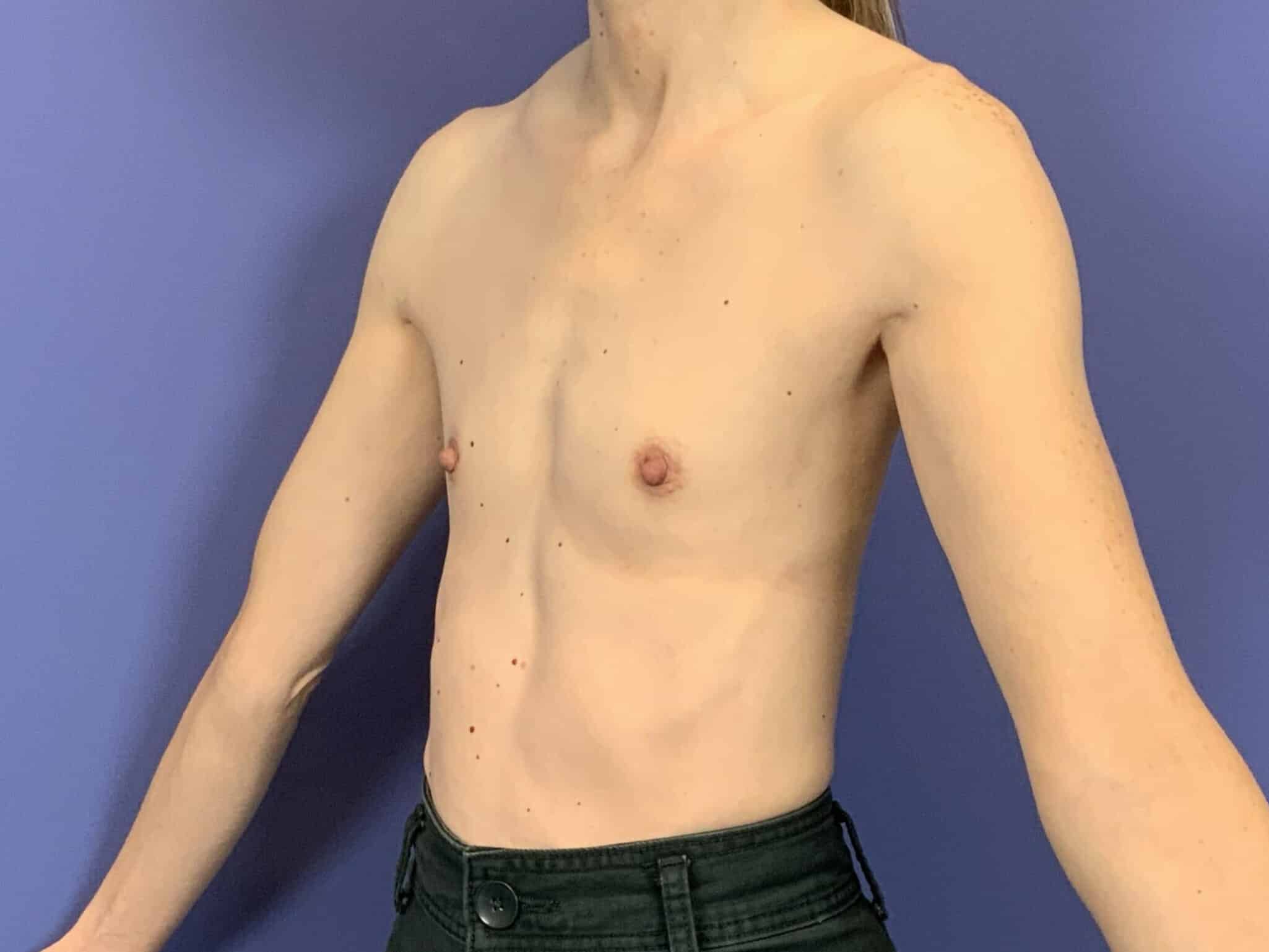 Before Image:  - left-front-oblique
