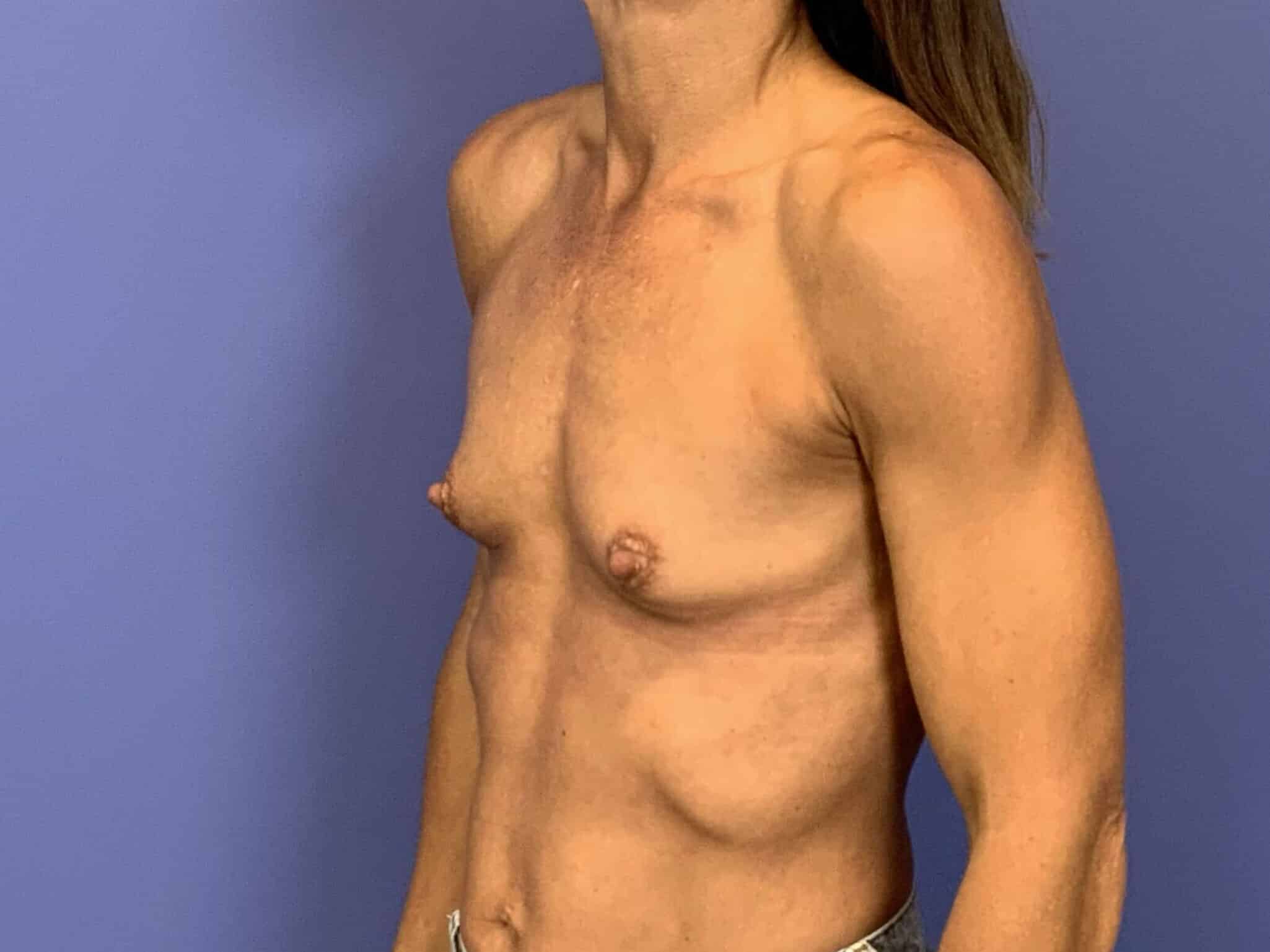 Before Image:  - left-front-oblique