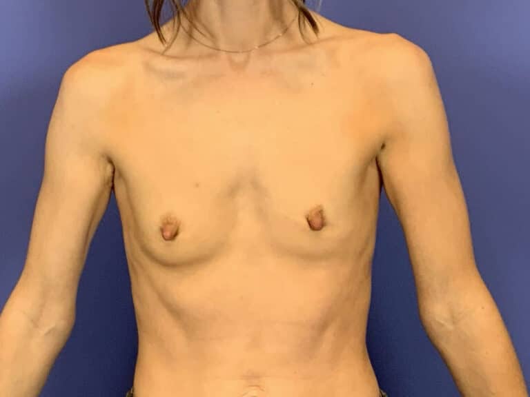 Before Image:  - front