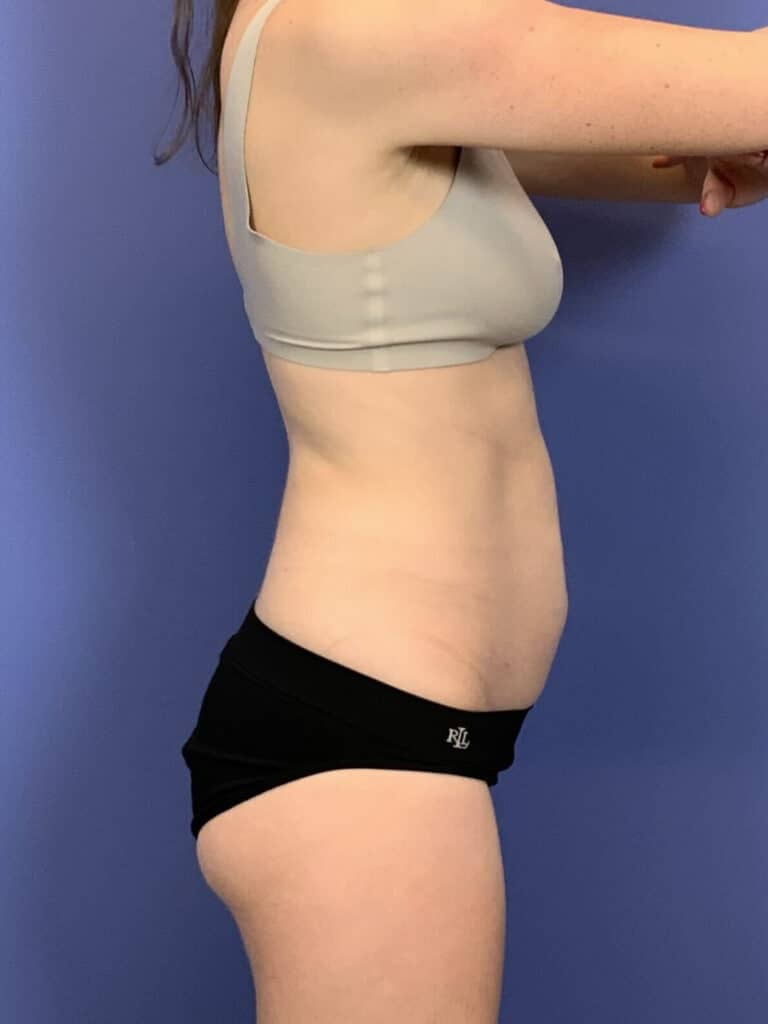 Before Image:  -