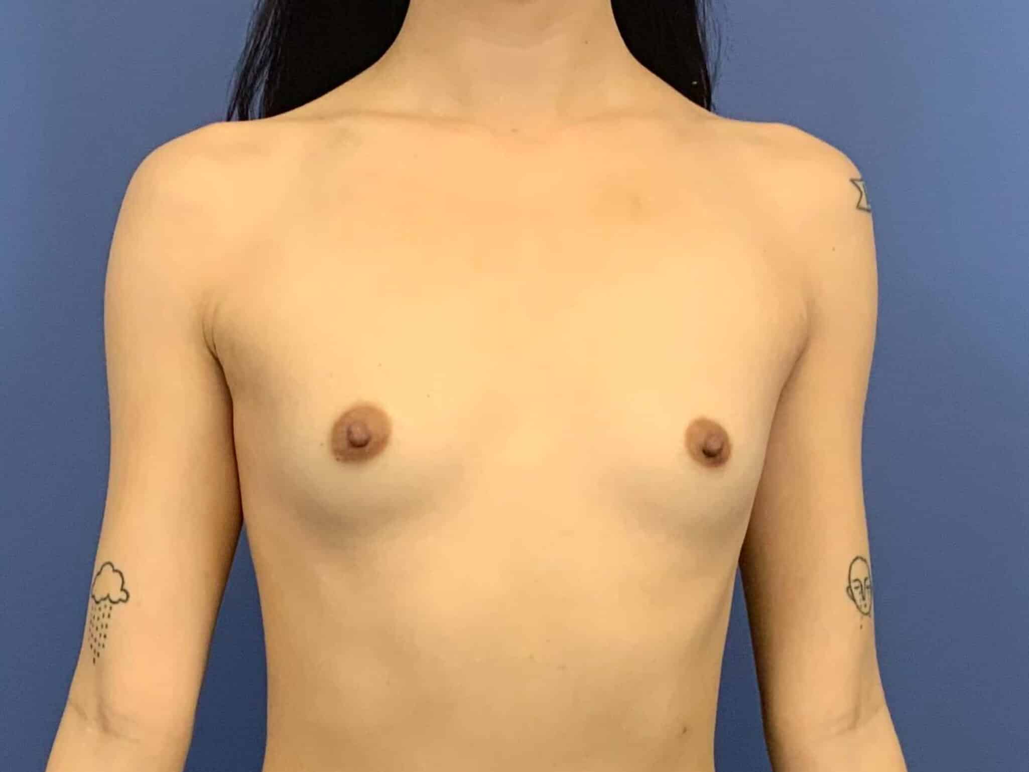 Before Image:  - front