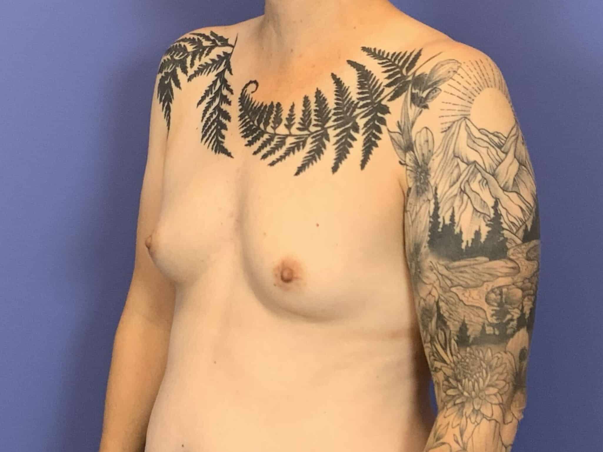 Before Image:  - left-front-oblique