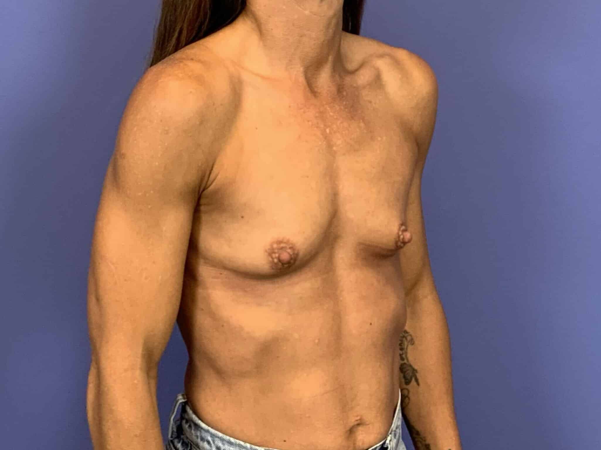 Before Image:  - right-front-oblique