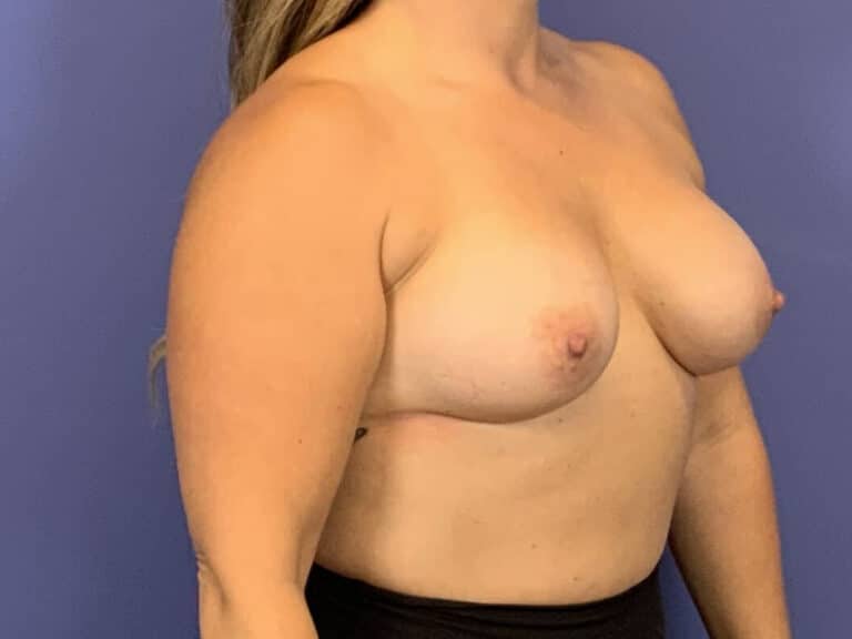 After Image:  - right-front-oblique