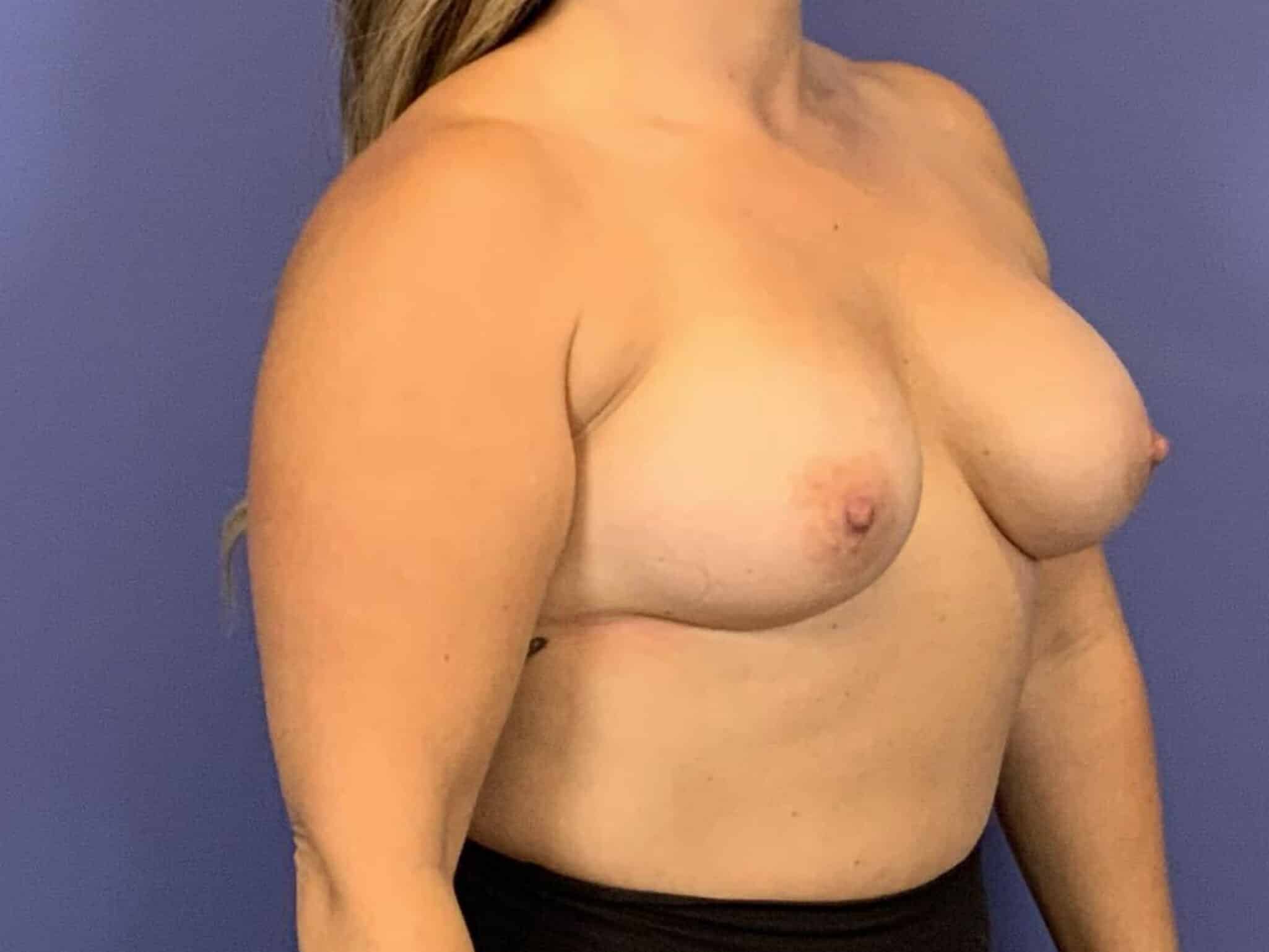 After Image:  - right-front-oblique