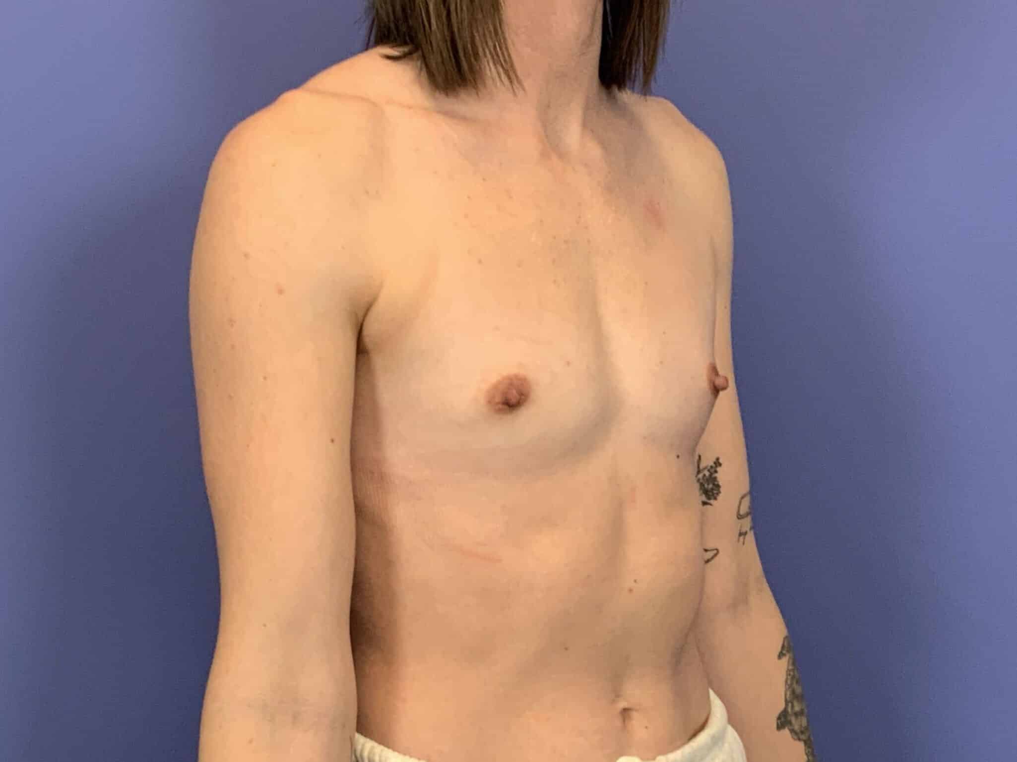 Before Image:  - right-front-oblique