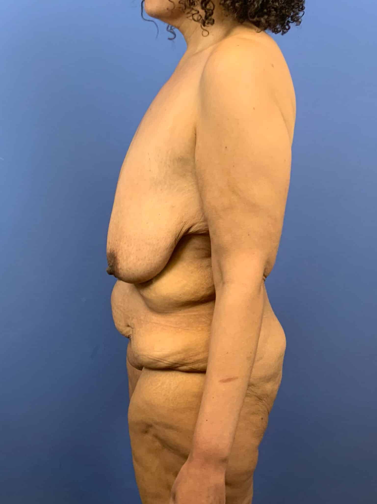 Before Image:  - left-side