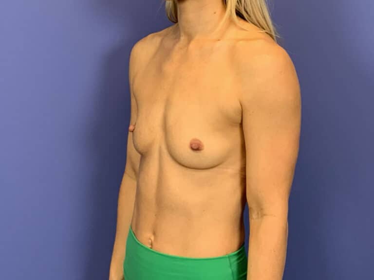 Before Image:  - left-front-oblique