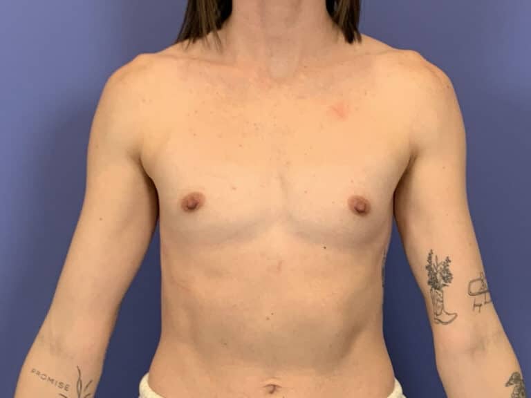 Before Image:  - front