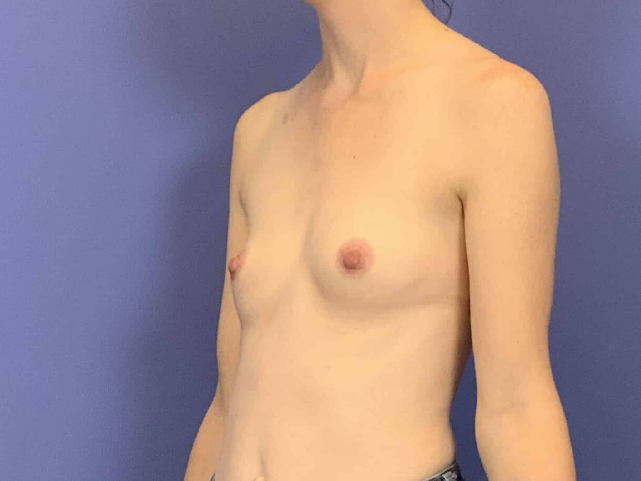 Before Image:  - left-front-oblique