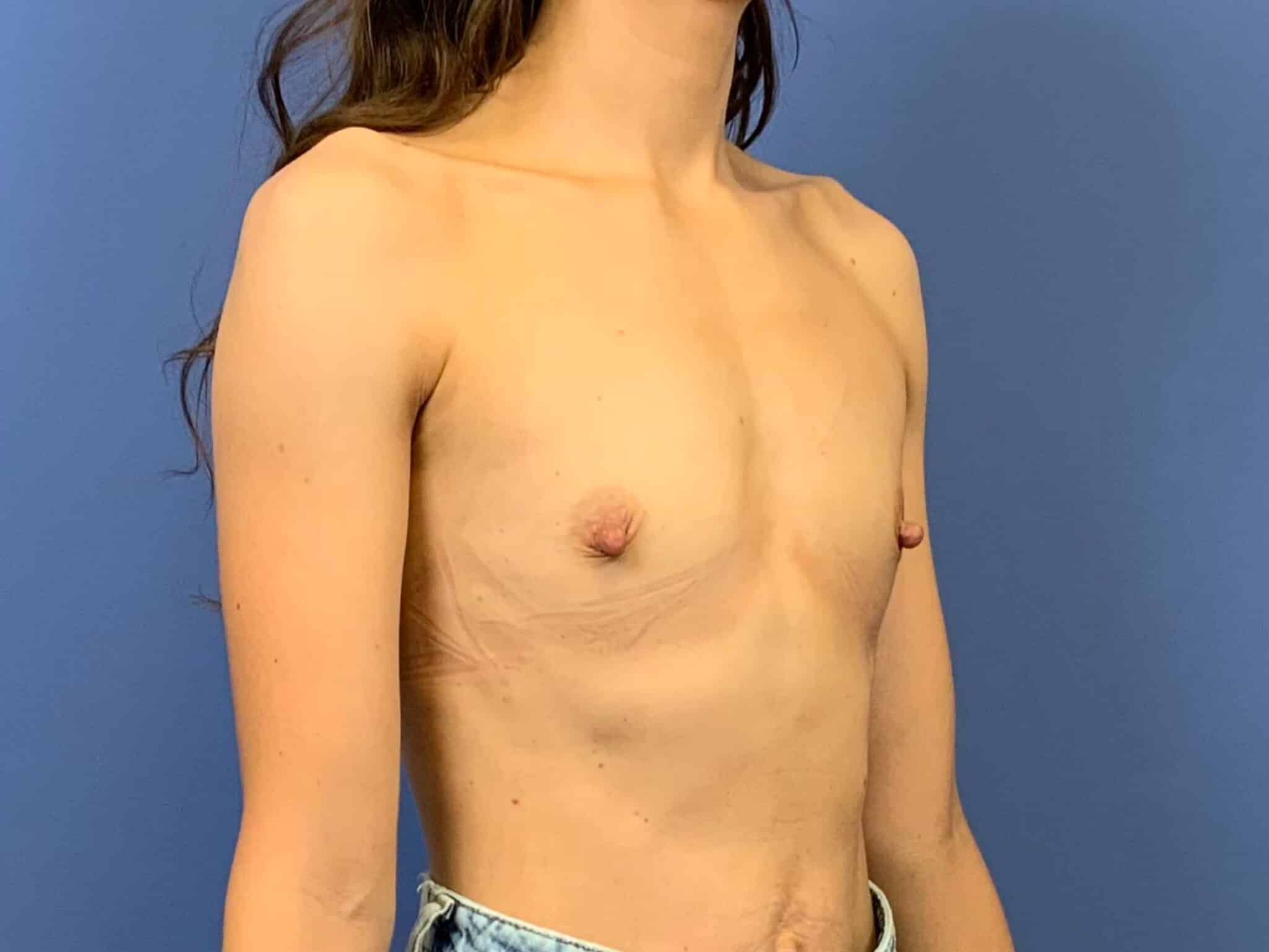Before Image:  - right-front-oblique