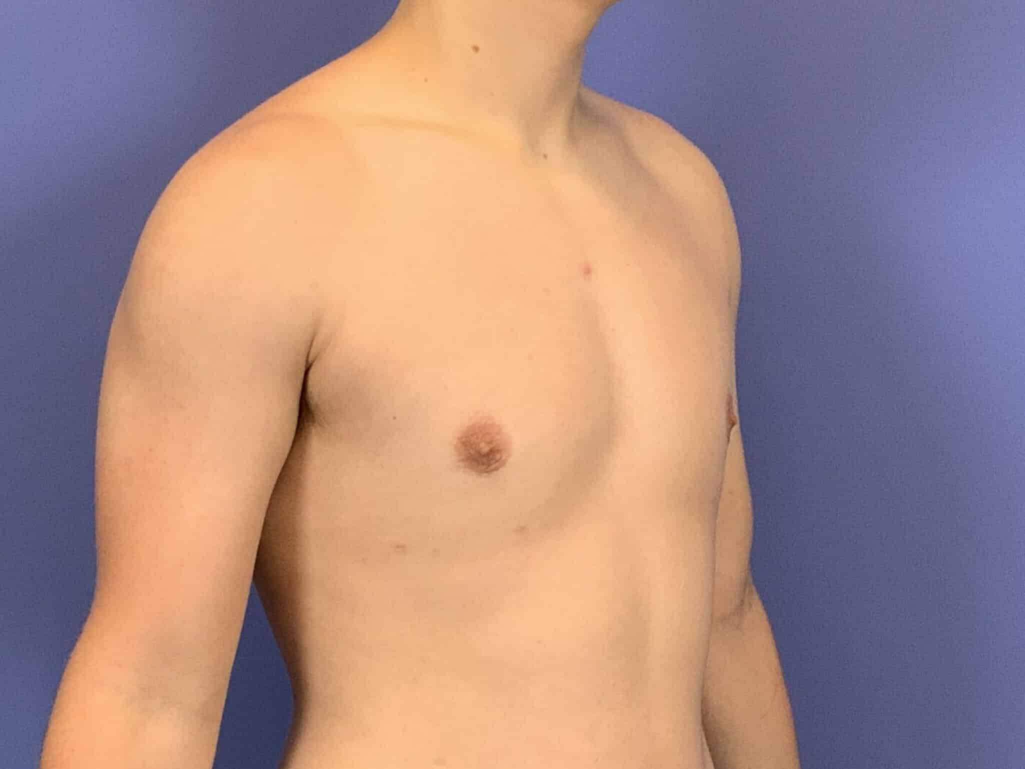 After Image:  - left-front-oblique