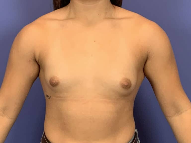 Before Image:  - front