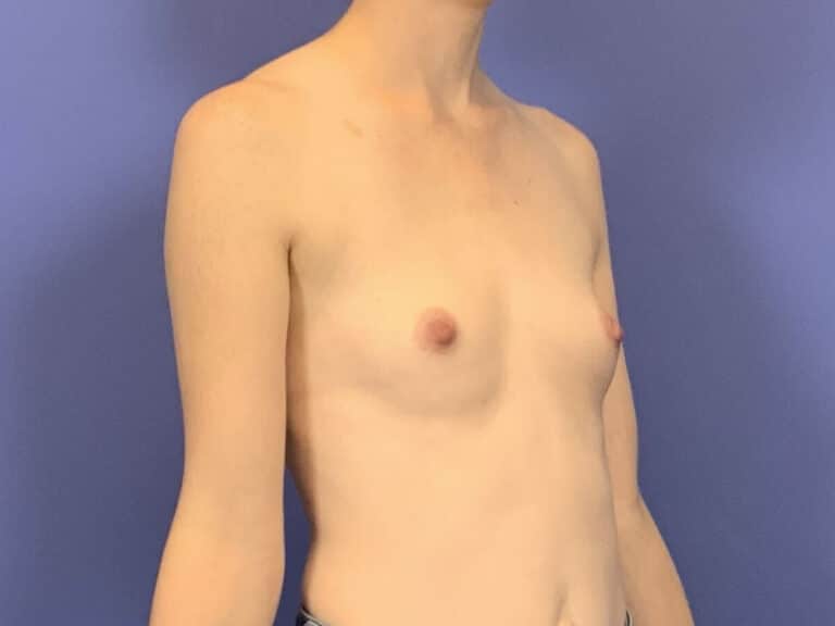Before Image:  - right-front-oblique