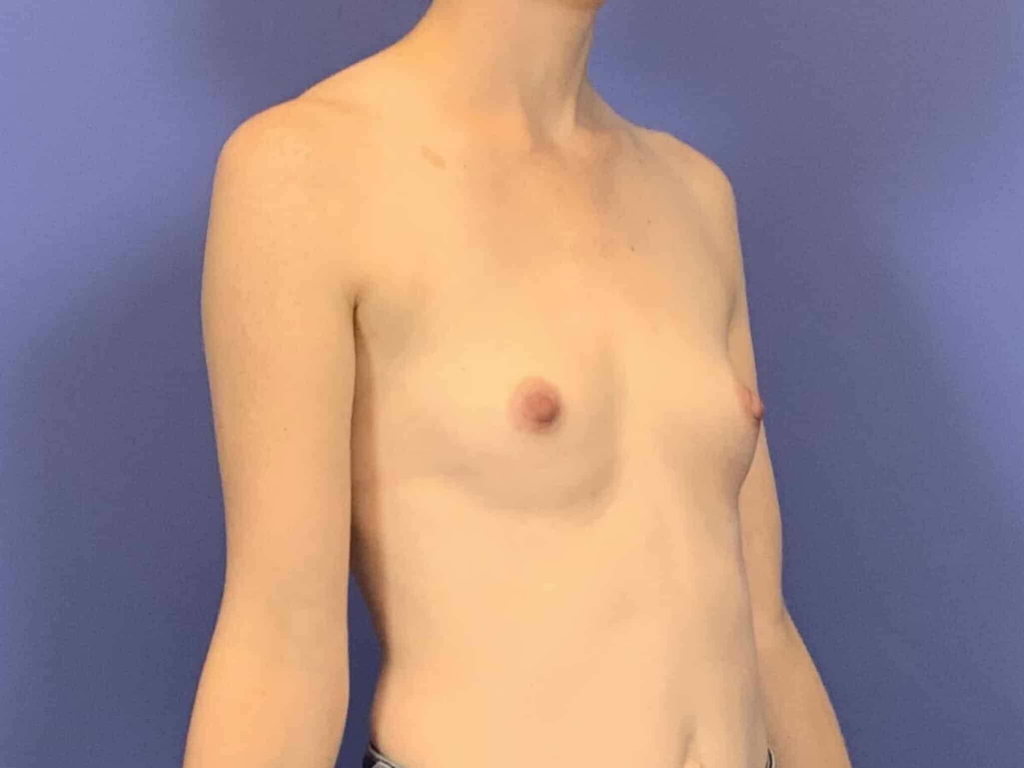 Before Image:  - right-front-oblique
