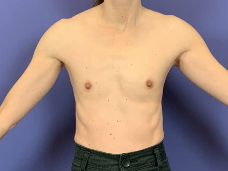 Before Image:  - front