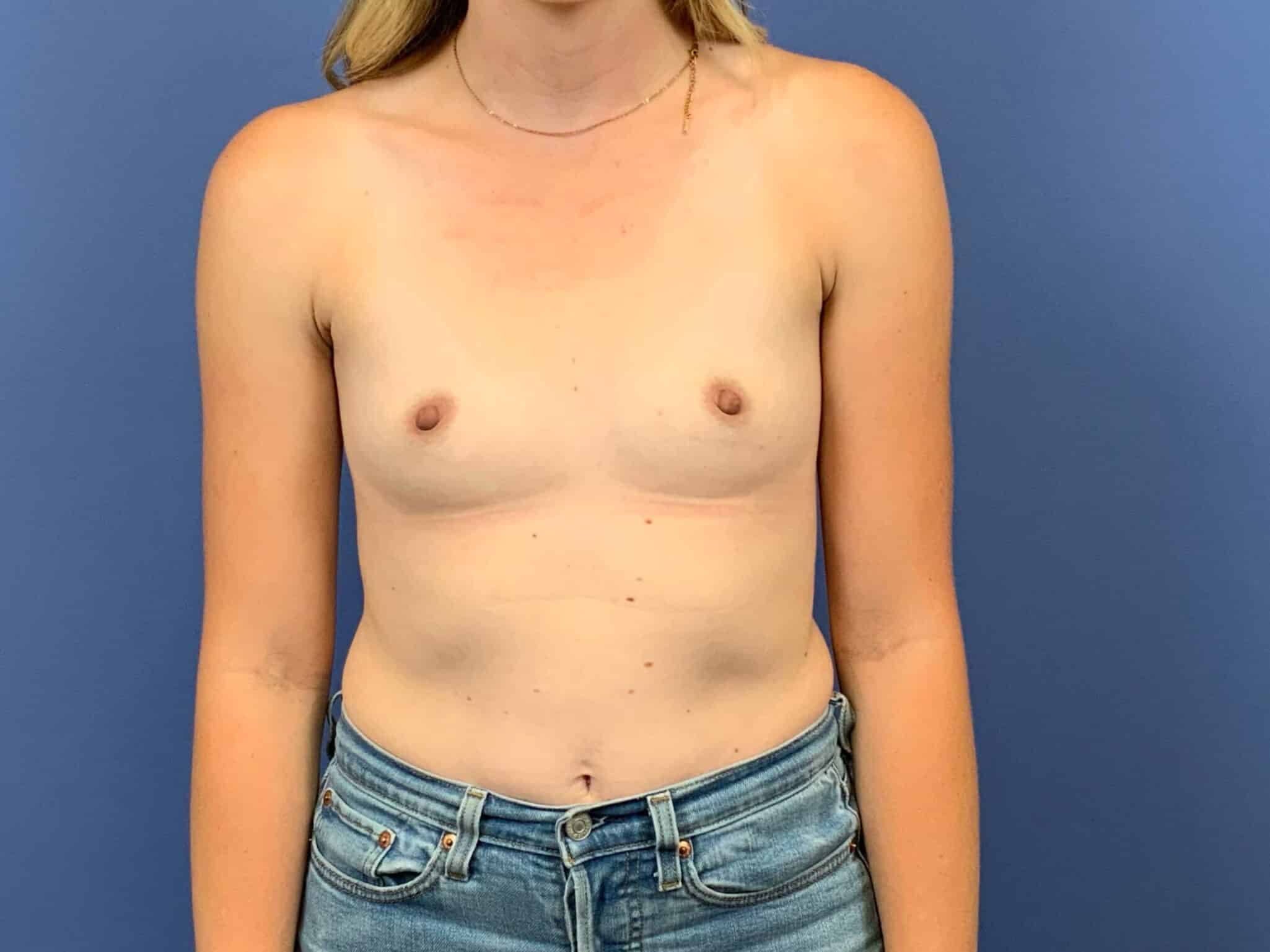 Before Image:  - front