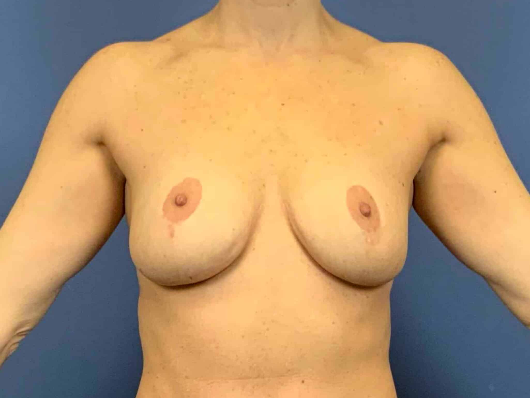 Before Image:  - front