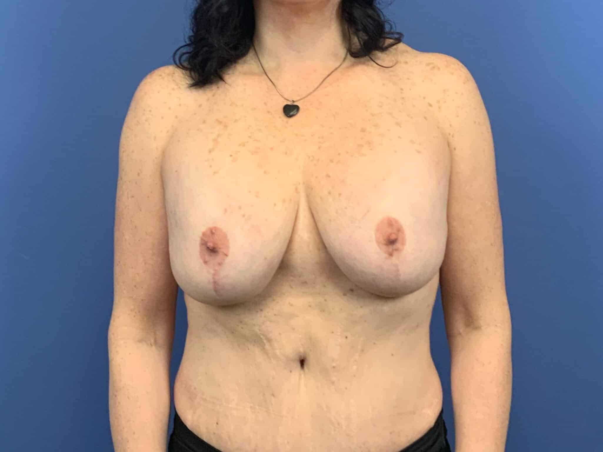 Before Image:  - front