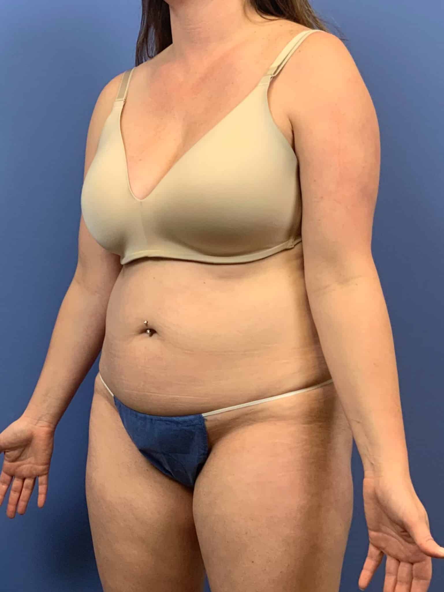 Before Image:  - left-front-oblique
