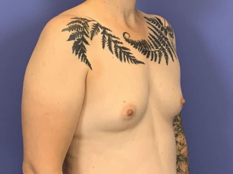 Before Image:  - right-front-oblique