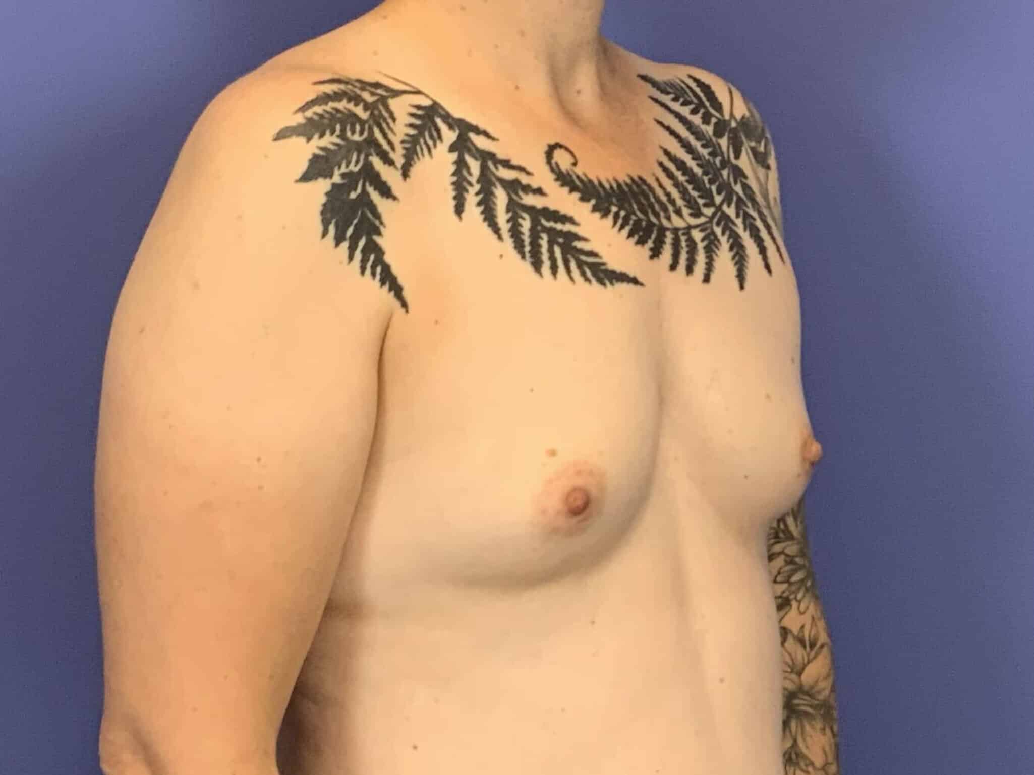Before Image:  - right-front-oblique