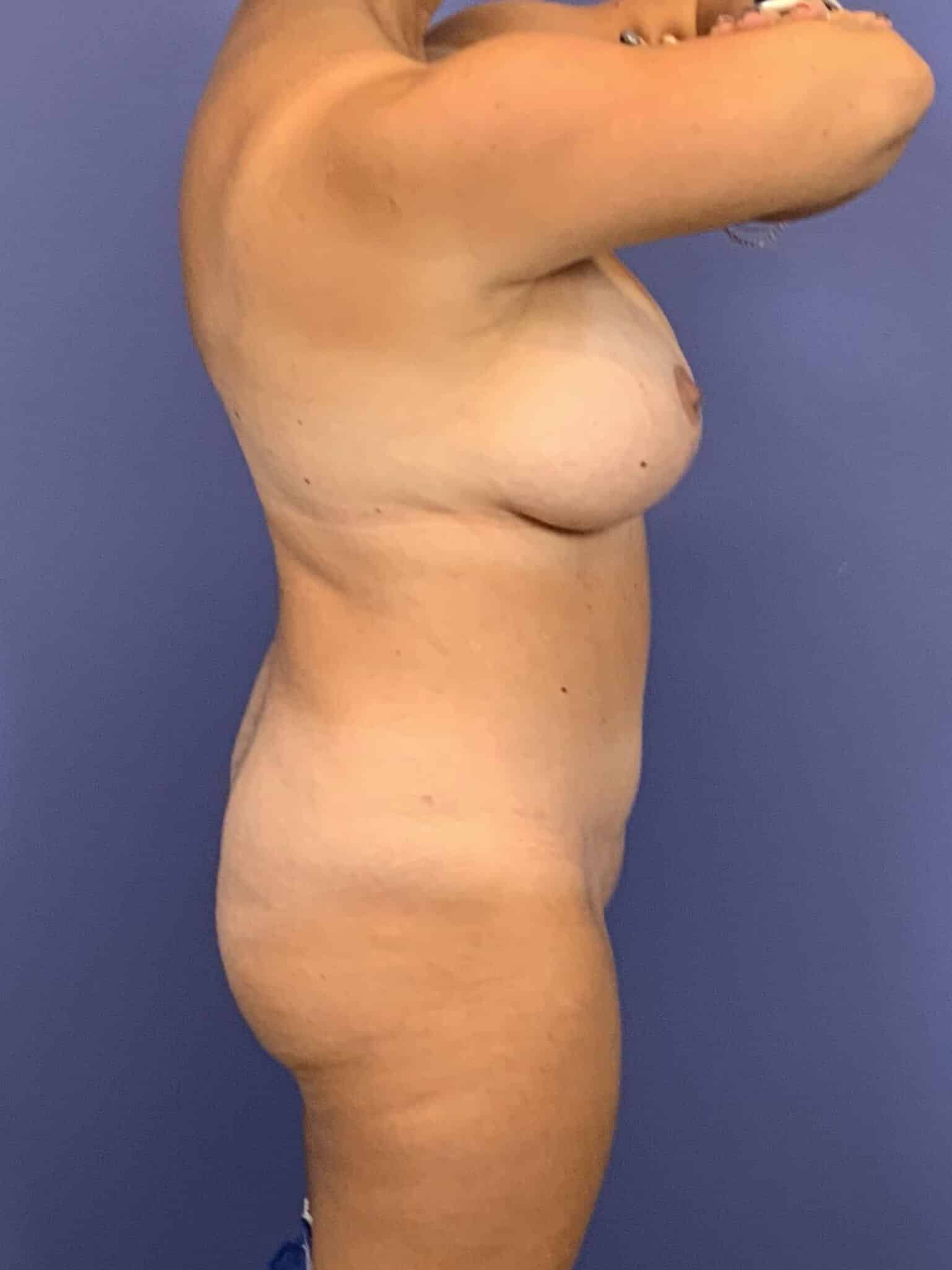 After Image:  - right-side