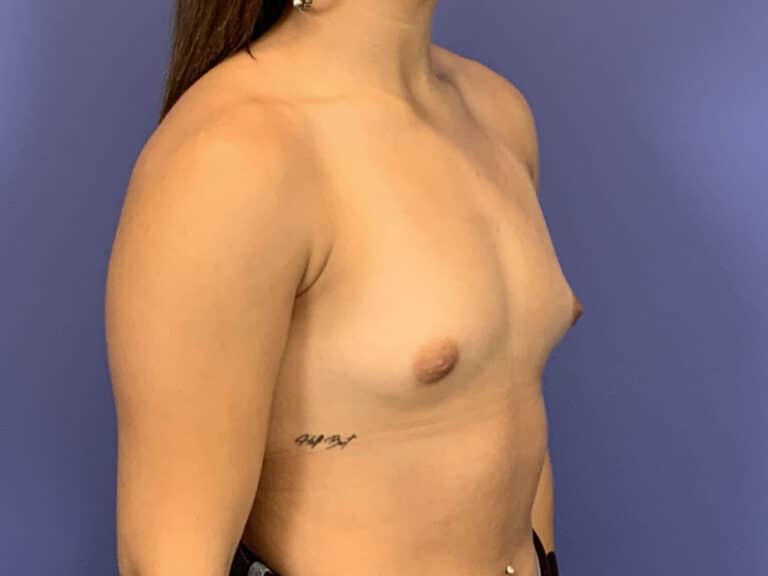Before Image:  - right-front-oblique