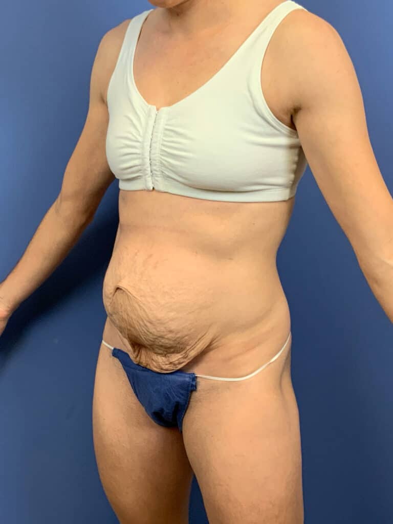 Before Image:  - left-front-oblique