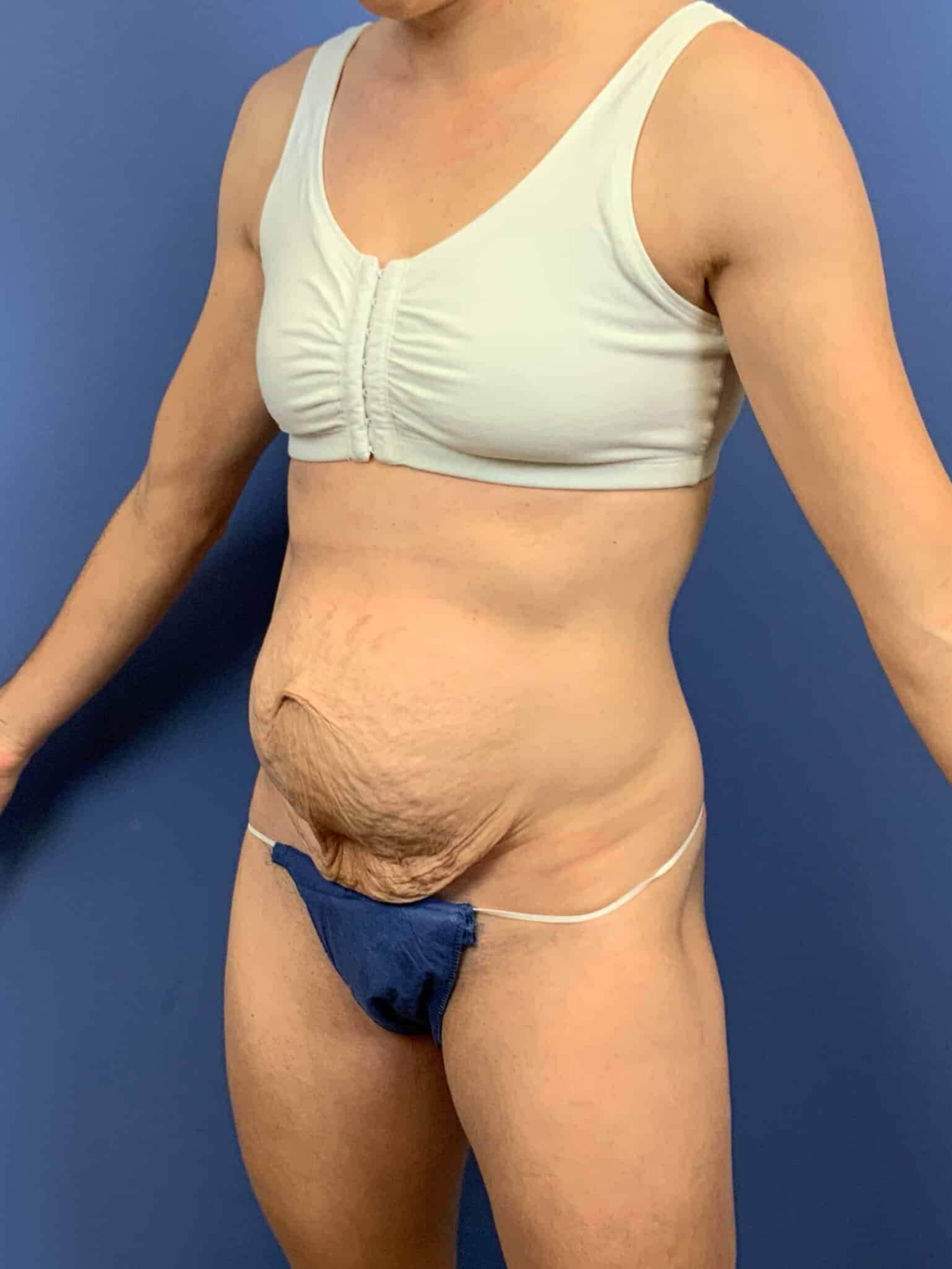 Before Image:  - left-front-oblique
