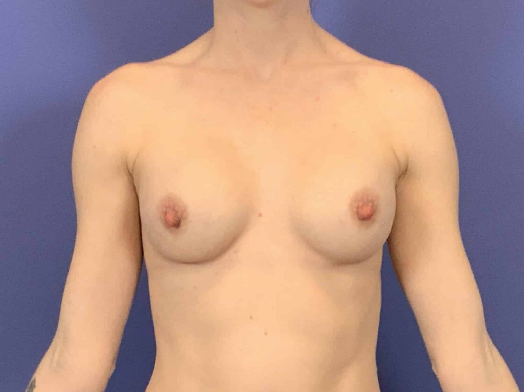 After Image:  - front
