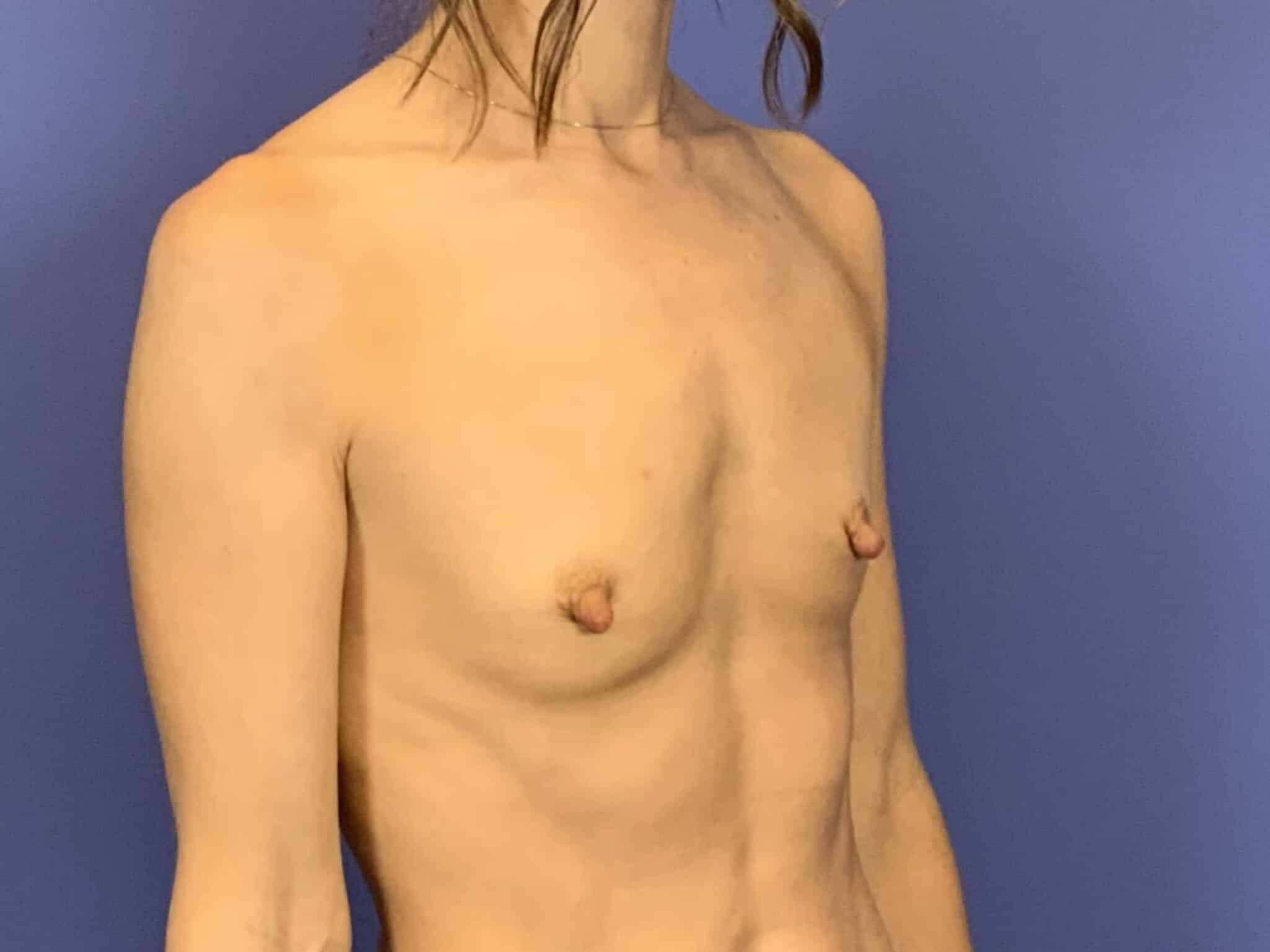 Before Image:  - front
