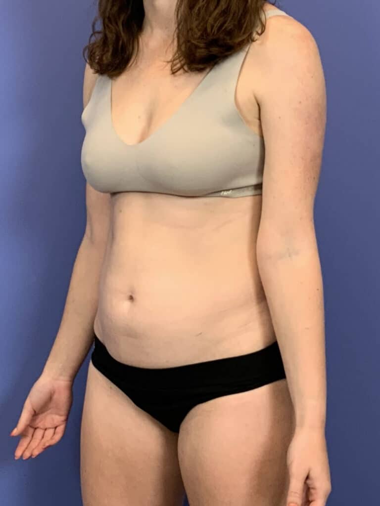 Before Image:  - left-front-oblique