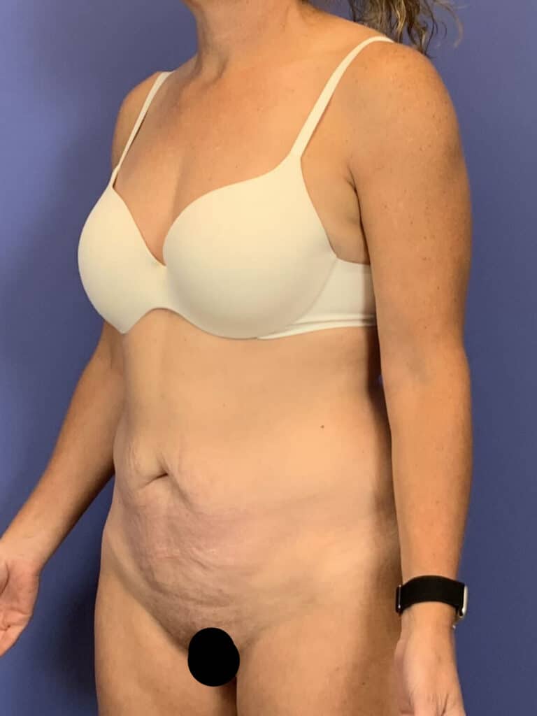 Before Image:  - left-front-oblique