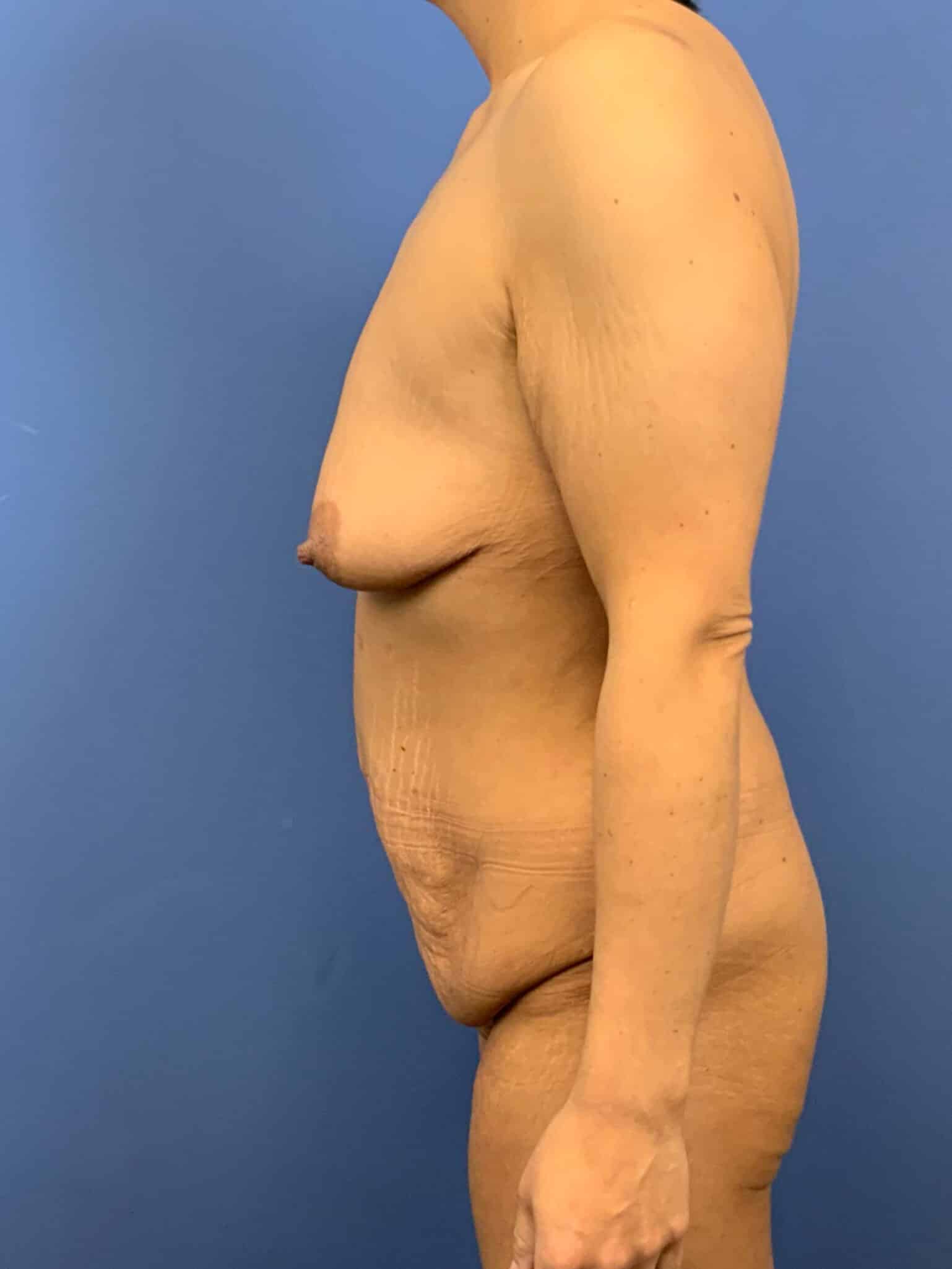 Before Image:  - left-side