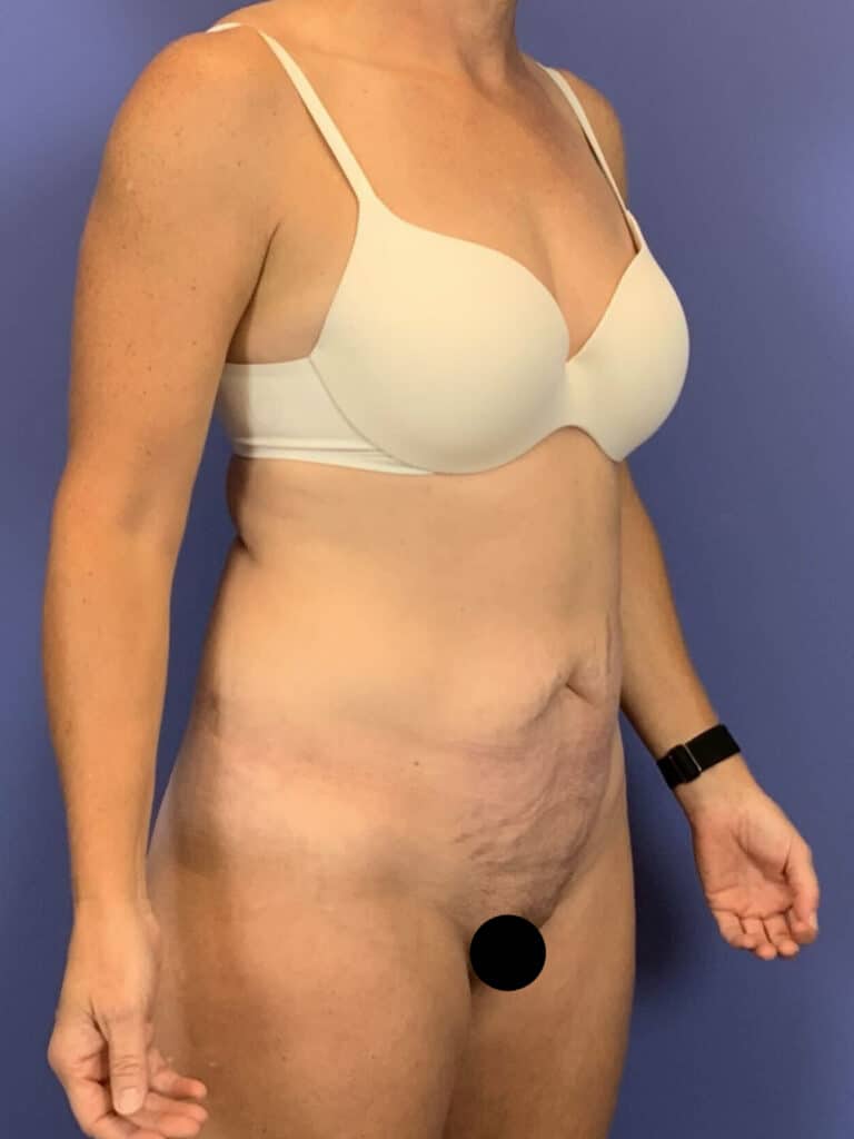 Before Image:  - right-front-oblique