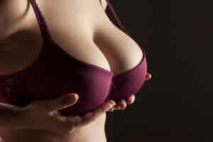 Woman with large breasts in bra who may be candidate for scarless breast reduction.