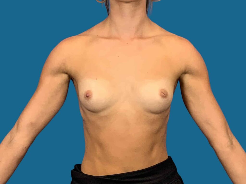 Before Image:  - front